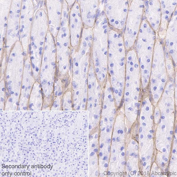 Anti Laminin Gamma Antibody Epr Ab Abcam