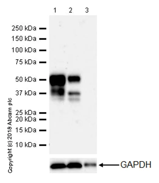 Western blot - Anti-0N Tau antibody [EPR21726] (AB218199)