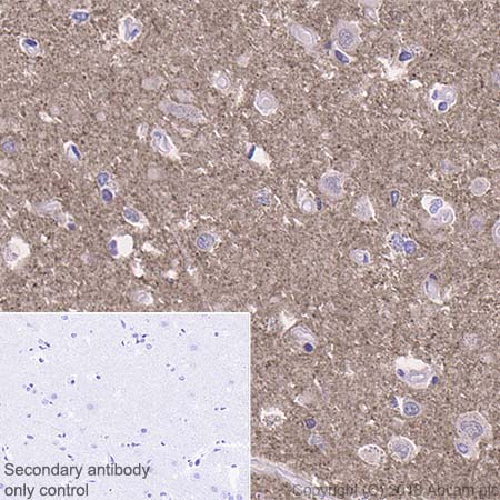 Immunohistochemistry (Formalin/PFA-fixed paraffin-embedded sections) - Anti-0N Tau antibody [EPR21726] - BSA and Azide free (AB242344), expandable thumbnail