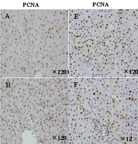 Immunohistochemistry (Formalin/PFA-fixed paraffin-embedded sections) - 100x Citrate Buffer pH 6.0 (AB64236)