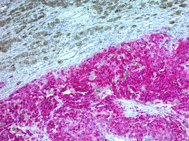 Immunohistochemistry (Formalin/PFA-fixed paraffin-embedded sections) - 10x EDTA Buffer pH 8.0 (AB64216)