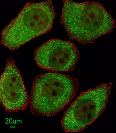 Immunocytochemistry/ Immunofluorescence - Anti-12 Lipoxygenase/ALOX12 antibody - C-terminal (AB211506)
