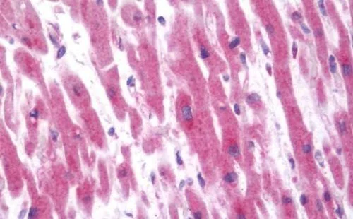 Immunohistochemistry (Formalin/PFA-fixed paraffin-embedded sections) - Anti-12 Lipoxygenase/ALOX12 antibody - C-terminal (AB211506)