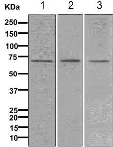 Western blot - Anti-12 Lipoxygenase/ALOX12 antibody [EPR11380(B)] (AB168384)