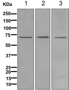 Western blot - Anti-12 Lipoxygenase/ALOX12 antibody [EPR11380(B)] (AB168384)