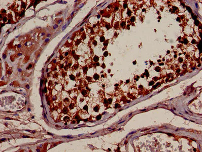 Immunohistochemistry (Formalin/PFA-fixed paraffin-embedded sections) - Anti-14-3-3 alpha + beta antibody (AB237807)