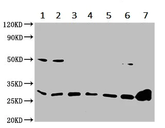 Western blot - Anti-14-3-3 alpha + beta antibody (AB237807)