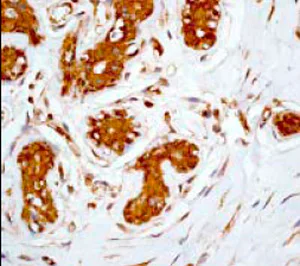 Immunohistochemistry (Formalin/PFA-fixed paraffin-embedded sections) - Anti-14-3-3 alpha + beta antibody [Y62] (AB32560)