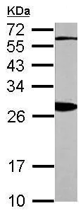 Western blot - Anti-14-3-3 beta antibody (AB97273)