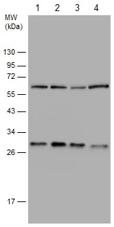 Western blot - Anti-14-3-3 beta antibody (AB97273)