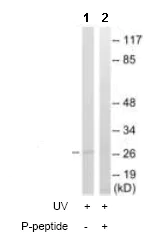 Western blot - Anti-14-3-3 beta + zeta (phospho S184 + S186) antibody (AB111856)