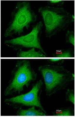 Immunocytochemistry/ Immunofluorescence - Anti-14-3-3 gamma/YWHAG antibody (AB155050)