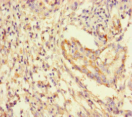 Immunohistochemistry (Formalin/PFA-fixed paraffin-embedded sections) - Anti-14-3-3 gamma/YWHAG antibody (AB237732)