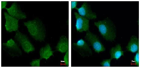 Immunocytochemistry/ Immunofluorescence - Anti-14-3-3 sigma/SFN antibody (AB151504)
