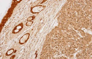 Immunohistochemistry (Formalin/PFA-fixed paraffin-embedded sections) - Anti-14-3-3 sigma/SFN antibody (AB151504)
