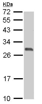 Western blot - Anti-14-3-3 sigma/SFN antibody (AB151504)
