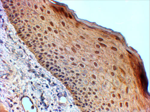 Immunohistochemistry (Formalin/PFA-fixed paraffin-embedded sections) - Anti-14-3-3 sigma/SFN antibody (AB77187)