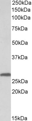 Western blot - Anti-14-3-3 sigma/SFN antibody (AB77187)
