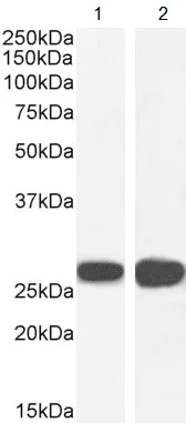Western blot - Anti-14-3-3 sigma/SFN antibody (AB77187)