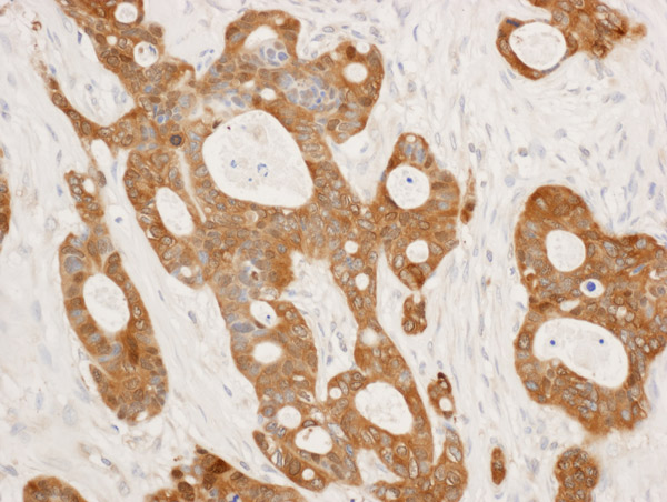 Immunohistochemistry (Formalin/PFA-fixed paraffin-embedded sections) - Anti-14-3-3 sigma/SFN antibody (AB86380), expandable thumbnail
