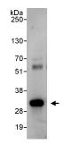 Immunoprecipitation - Anti-14-3-3 sigma/SFN antibody (AB86380), expandable thumbnail