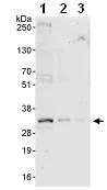 Western blot - Anti-14-3-3 sigma/SFN antibody (AB86380)