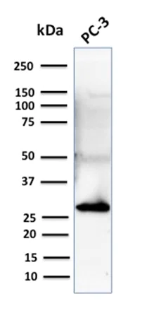 Western blot - Anti-14-3-3 sigma/SFN antibody [CPTC-SFN-2] (AB268067)