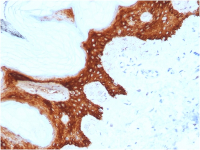 Immunohistochemistry (Formalin/PFA-fixed paraffin-embedded sections) - Anti-14-3-3 sigma/SFN antibody [CPTC-SFN-2] - BSA and Azide free (AB268188), expandable thumbnail