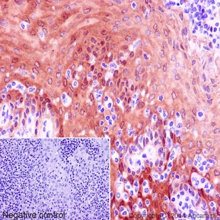 Immunohistochemistry (Formalin/PFA-fixed paraffin-embedded sections) - Anti-14-3-3 sigma/SFN antibody [EPR5873(2)] (AB193667), expandable thumbnail