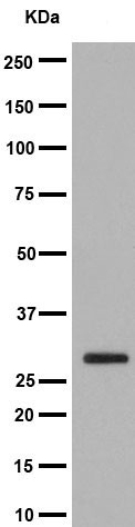 Western blot - Anti-14-3-3 sigma/SFN antibody [EPR5873(2)] (AB193667), expandable thumbnail