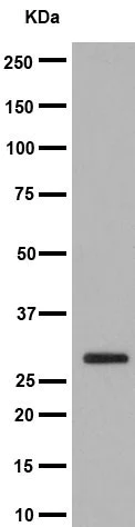 Western blot - Anti-14-3-3 sigma/SFN antibody [EPR5873(2)] (AB193667)