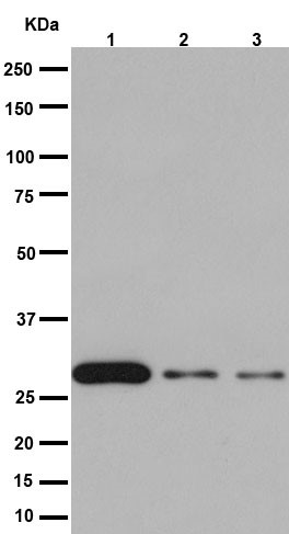 Western blot - Anti-14-3-3 sigma/SFN antibody [EPR5873(2)] (AB193667), expandable thumbnail