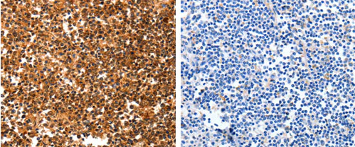 Immunohistochemistry (Formalin/PFA-fixed paraffin-embedded sections) - Anti-14-3-3 theta antibody (AB183075)