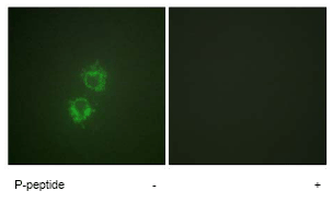 Immunocytochemistry/ Immunofluorescence - Anti-14-3-3 Theta + Tau (phospho S232) antibody (AB63369)