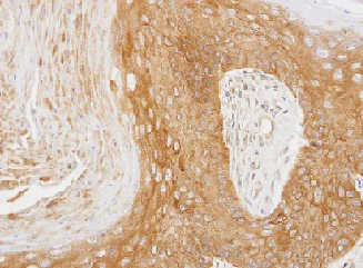 Immunohistochemistry (Formalin/PFA-fixed paraffin-embedded sections) - Anti-14-3-3 zeta antibody (AB155037)