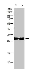 Western blot - Anti-14-3-3 zeta antibody (AB155037)