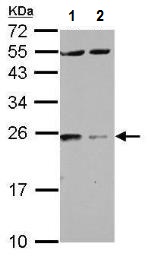 Western blot - Anti-14-3-3 zeta antibody (AB262708)