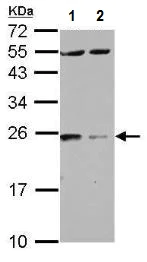 Western blot - Anti-14-3-3 zeta antibody (AB262708)