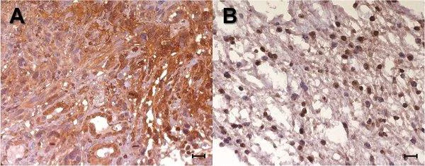 Immunohistochemistry (Formalin/PFA-fixed paraffin-embedded sections) - Anti-14-3-3 zeta antibody (AB51129)