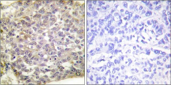 Immunohistochemistry (Formalin/PFA-fixed paraffin-embedded sections) - Anti-14-3-3 zeta antibody (AB51129)