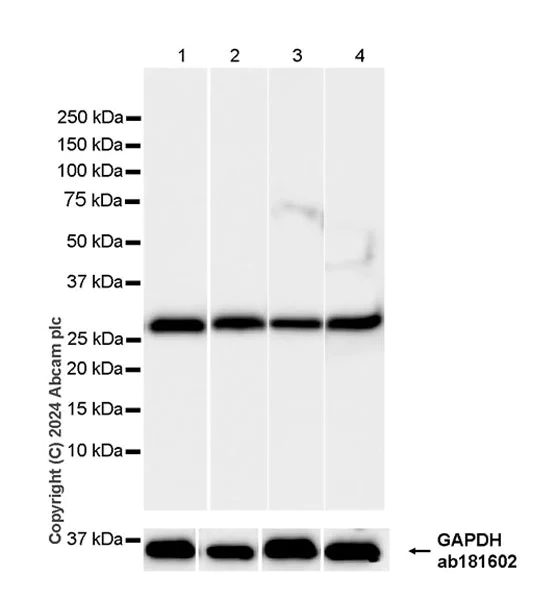 Western blot - Anti-14-3-3 zeta antibody [EPR27044-19] - BSA and Azide free (AB317439)