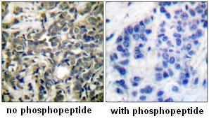 Immunohistochemistry (Formalin/PFA-fixed paraffin-embedded sections) - Anti-14-3-3 zeta (phospho S58) antibody (AB51109)