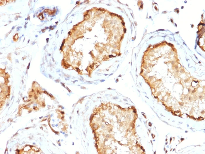 Immunohistochemistry (Formalin/PFA-fixed paraffin-embedded sections) - Anti-14-3-3E / Tryptophan 5-Monooxygenase Antibody [CPTC-YWHAE-1] (AB268130)