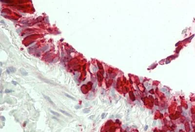 Immunohistochemistry (Formalin/PFA-fixed paraffin-embedded sections) - Anti-15 Lipoxygenase 1 antibody [7H6] (AB230919)