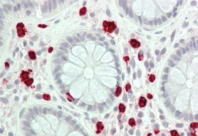 Immunohistochemistry (Formalin/PFA-fixed paraffin-embedded sections) - Anti-15 Lipoxygenase 1 antibody [7H6] (AB230919)
