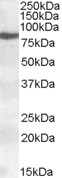 Western blot - Anti-15 Lipoxygenase 1 antibody (AB80495)