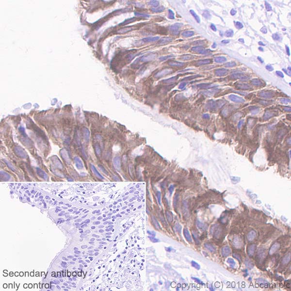 Immunohistochemistry (Formalin/PFA-fixed paraffin-embedded sections) - Anti-15 Lipoxygenase 1 antibody [EPR22136] (AB242062), expandable thumbnail