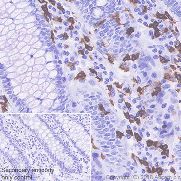 Immunohistochemistry (Formalin/PFA-fixed paraffin-embedded sections) - Anti-15 Lipoxygenase 1 antibody [EPR22136] (AB242062), expandable thumbnail
