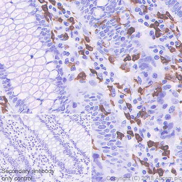 Immunohistochemistry (Formalin/PFA-fixed paraffin-embedded sections) - Anti-15 Lipoxygenase 1 antibody [EPR22136] (AB242062)