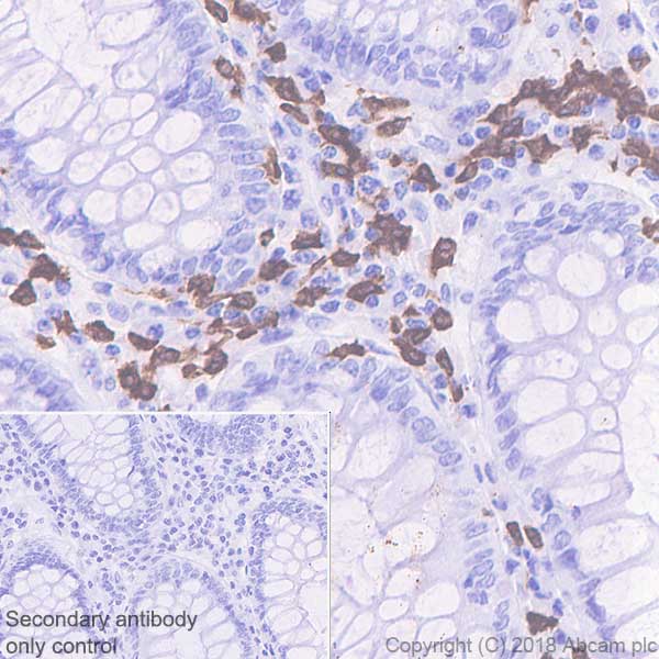 Immunohistochemistry (Formalin/PFA-fixed paraffin-embedded sections) - Anti-15 Lipoxygenase 1 antibody [EPR22138] (AB244205)
